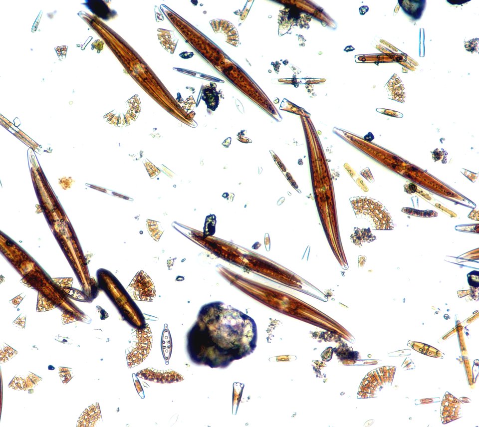 Fig. 1. Zbiorowisko „żywych” okrzemek – obserwacja w mikroskopie świetlnym (LM)