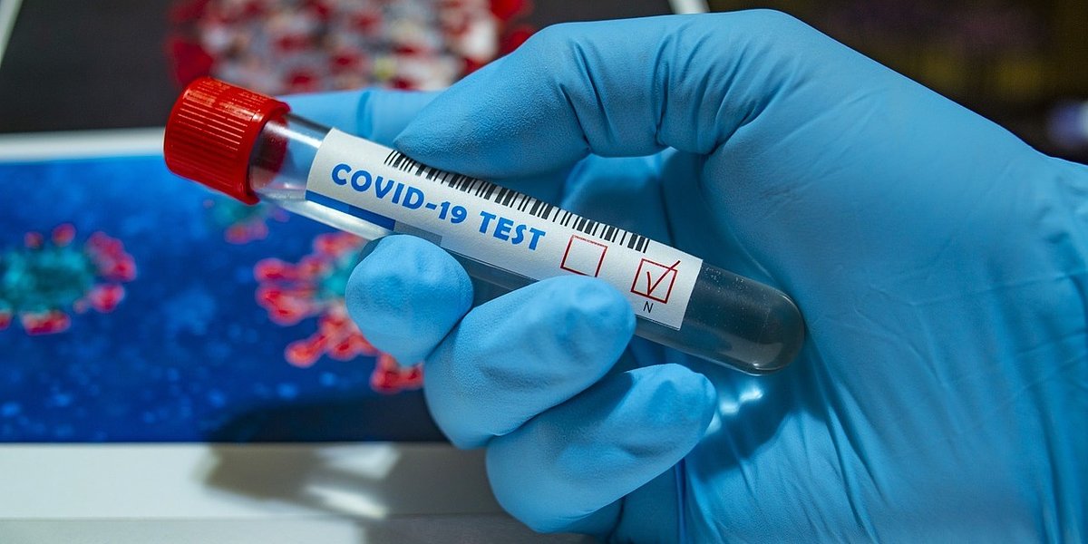 Czy studenci farmacji mogą skorzystać za darmo z testów na koronawirusa?