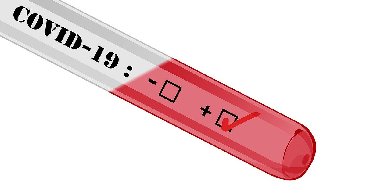 Pilne! Szybka ścieżka testów na koronawirusa także dla farmaceutów i techników
