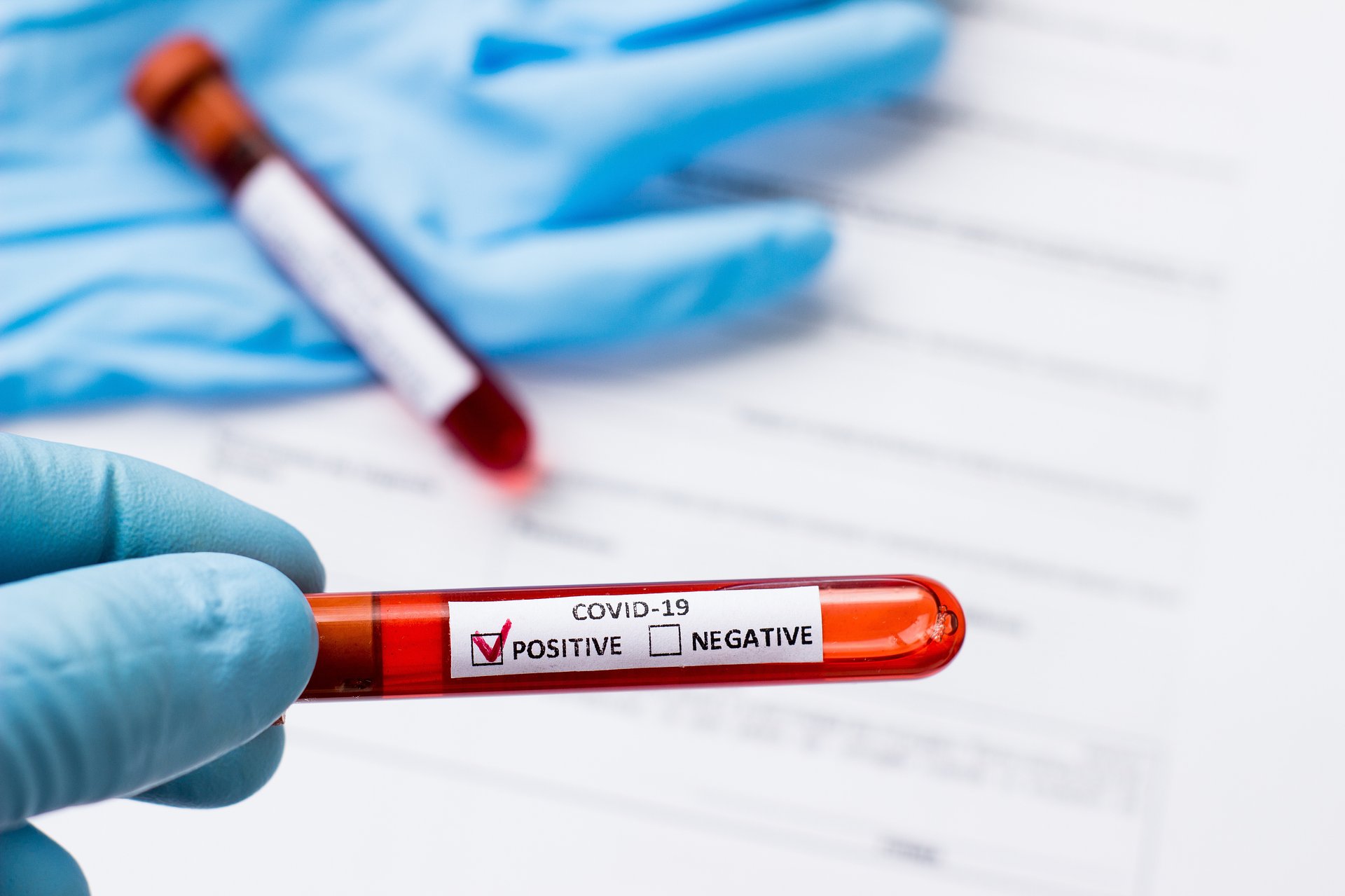 Szybki dostęp do testów na COVID-19 dla farmaceutów tylko na papierze?